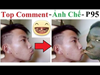 Top Comment 😂 Ảnh Chế (P 95) Funny Photos, Photoshop Troll, Funny Pictures, Chỉnh sửa ảnh Free